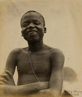 758px-_Pygmy_showing_mutilated_teeth.__Ota_Benga_Pygmy_from_Belgian_Congo_in_the_Department_of_Anthropology_at_the_1904_Worlds_Fair.jpg